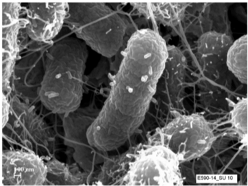 BacteriavsVirus_Bluephage