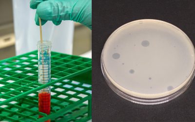 PCR versus cultural methods to detect coliphages